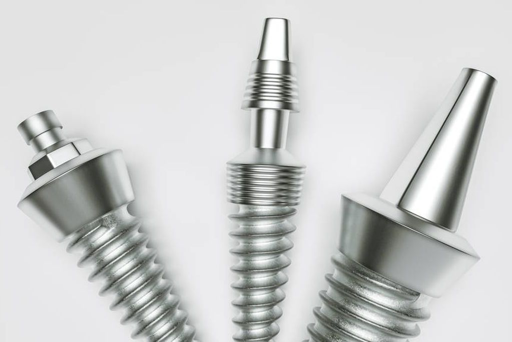 Oralna kirurgija i implantologija - ugradnja implantata