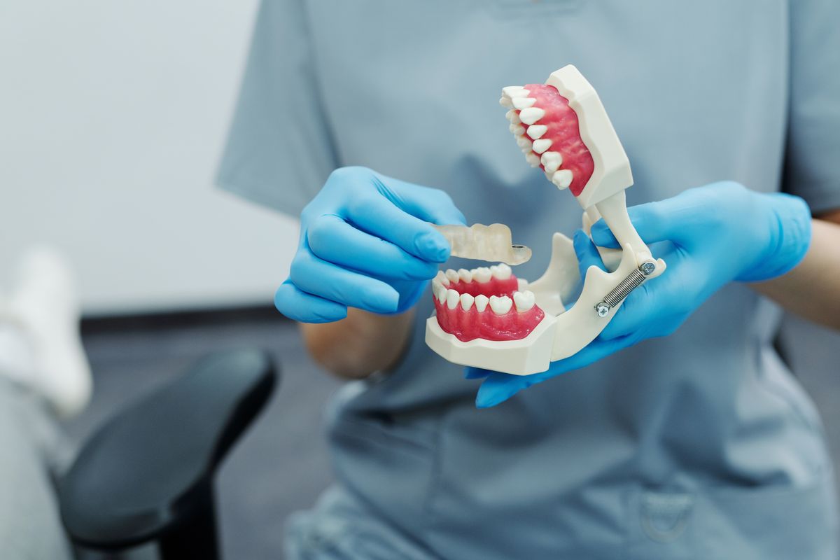 Stomatološke usluge - Dental Point - Paradontologija