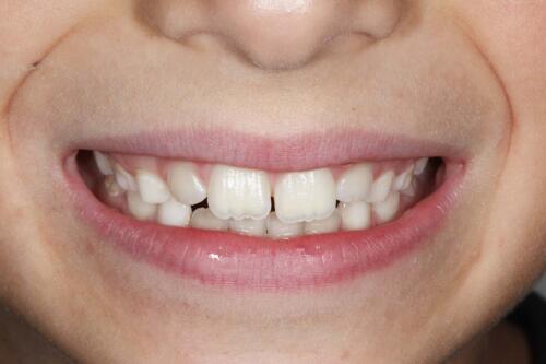 Dental-point galerija_35