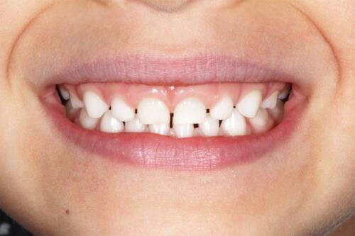 Dental-point galerija_36